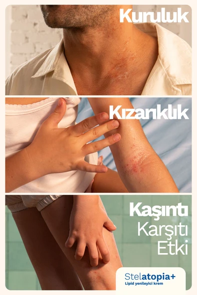 Mustela Organik Sertifikalı Stelatopia+ Çok Kuru ve Atopik Cilt Nemlendirici Krem Bebek Çocuk Yetişkin 150ml - 4