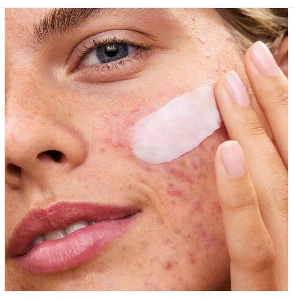 First Aid Beauty Ultra Repair Rescue Balm - Dimetikonlu Ultra Onarıcı Rahatlatıcı Balsam 64 gr - 4