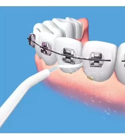 Zhltools Ergonomik Tasarım Power Floss Mekanik Diş Ve Ağız Temizleme Aleti - 2
