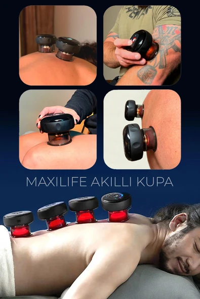 Smart Cupper Şarjlı Kupa Çekme Işık Tedavili Hacamat Masaj Vakum Cihazı - 3