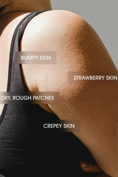 Advanced Clinicals 10% Glycolic + Lactic Acid Vücut Kremi 454GR - 3