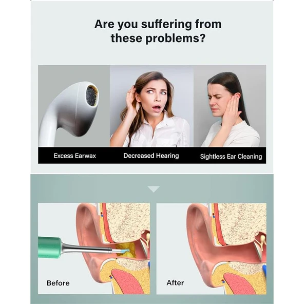 BEBIRD T5 3MP KAMERA 3.5MM LENS ŞARJLI WIFI GÖRÜNTÜLÜ KULAK TEMİZLEYİCİ YEŞİL RENK - 2