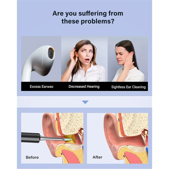 BEBIRD T5 3MP KAMERA 3.5MM LENS ŞARJLI WIFI GÖRÜNTÜLÜ KULAK TEMİZLEYİCİ SİYAH RENK - 2