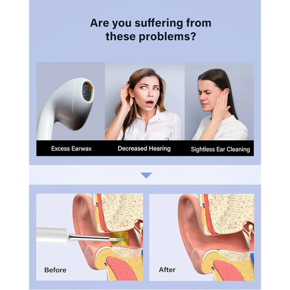 BEBIRD T5 3MP KAMERA 3.5MM LENS ŞARJLI WIFI GÖRÜNTÜLÜ KULAK TEMİZLEYİCİ BEYAZ RENK - 2