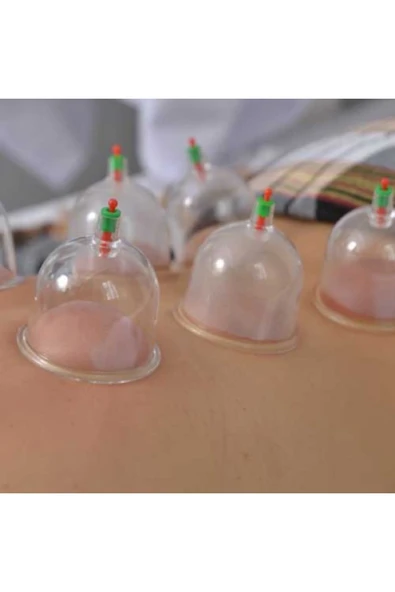 Hacamat Kupa Seti 6 Adet - Resim 3