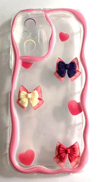 Xiaomi Redmi Note 10 Pro Uyumlu Süslü Objeli Şeffaf Kılıf ürün görseli 1