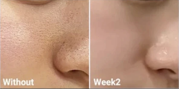 MEDICUBE Zero Pore Toner (Gözenek Karşıtı Tonik)(GLOBALCARE) - 3