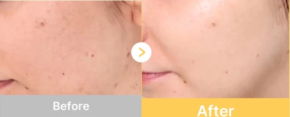 medicube - Kojic Acid Turmeric Brightening Gel Mask(Aydınlatıcı Jel Maske)(GLOBALCARE) - 3