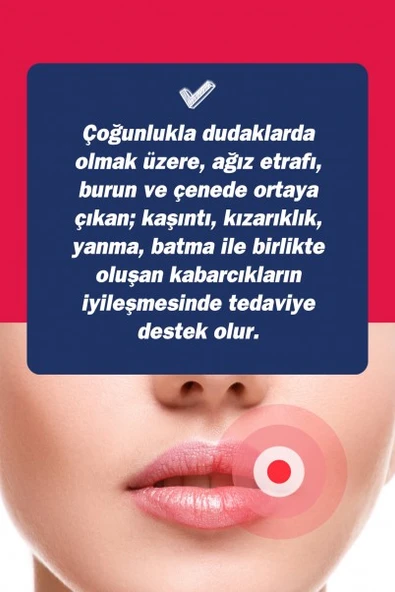 TTO UX DUDAK KREMİ 10 ML - Resim 3