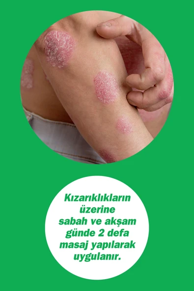 DERMODICOS KREM 30 ML - 5