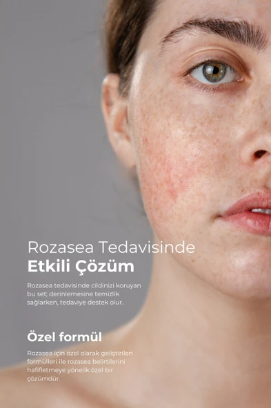 TTO AKNE-ROZASEA BAKIM SETİ - Resim 2