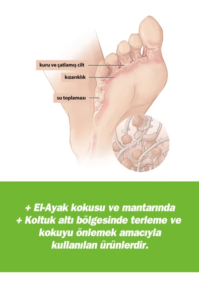 TRX TERLEME ÖNLEYİCİ SET - Resim 5