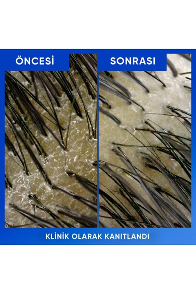 Head&Shoulders Arındırma&Parlaklık Kepeğe Karşı Etkili Şampuan 800 ml - 6