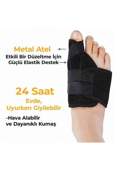 Ayak Ateli Ayak Baş Parmak Bunyon Koruyucu 1 Çift (SAĞ VE SOL) (Gece Ateli EX-89) - 2
