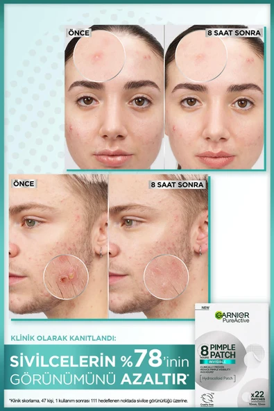 Garnier Pureactive Cilt Kusurlarına Karşı Band 22 Adet - 3