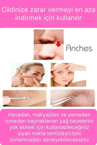 Siyah Nokta Akne Temizleyici Giderici Çıkarıcı Cilt Bakım 4'lü Set Kutulu Yağ bezesi Sivilce İğnesi - Resim 3