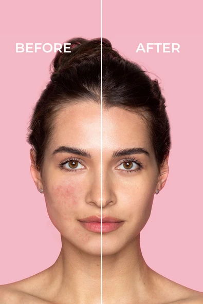 SİNOZ Pure Cica Tiger Grass Ton Eşitleyici Yoğun Onarıcı Yatıştırıcı Kızarıklık Karşıtı Yüz Kremi 15 ml - 2