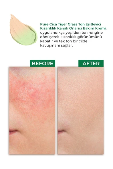 SİNOZ Pure Cica Tiger Grass Ton Eşitleyici Yoğun Onarıcı Yatıştırıcı Kızarıklık Karşıtı Yüz Kremi 15 ml - 5