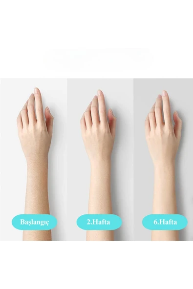 Iplv15 Pro Vücut -yüz- Bikini Başlıklı Ağrısız Otomatik Ve Manuel Atım Buz Lazer Epilasyon Cihazı - 3