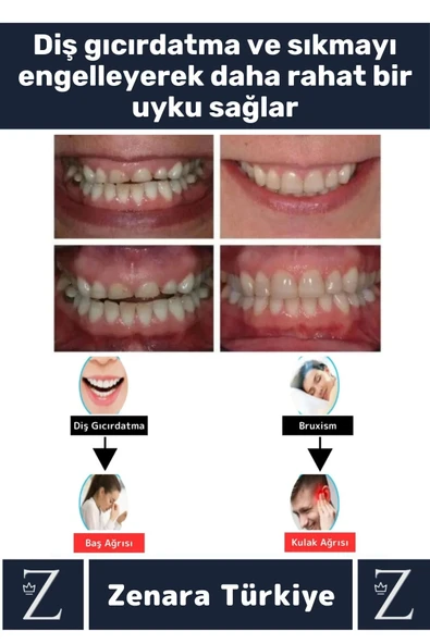 Premium Diş Çene Sıkma Gıcırdatma Bruksizm Önleme Gece Plağı Koruyucu Uyku Aparatı +Protez Kap - 2