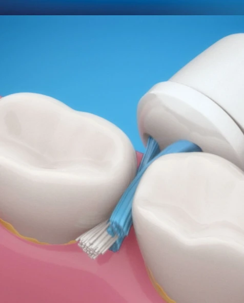 5D NEW WHITE Oral B Uyumlu ORTODONTİK Clean Döner Başlık - 2