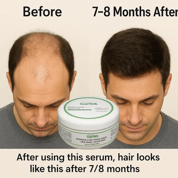 GARLEX YOĞUN BAKIMLI SAÇ ÇIKARAN VE GÜÇLENDİREN MASKE,250 ML