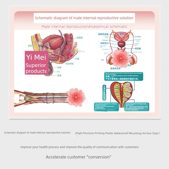 Jinekolojik Anatomi Atlası Poster - Erkek İç Üreme Anatomisi Şematik Diyagramı - A4
