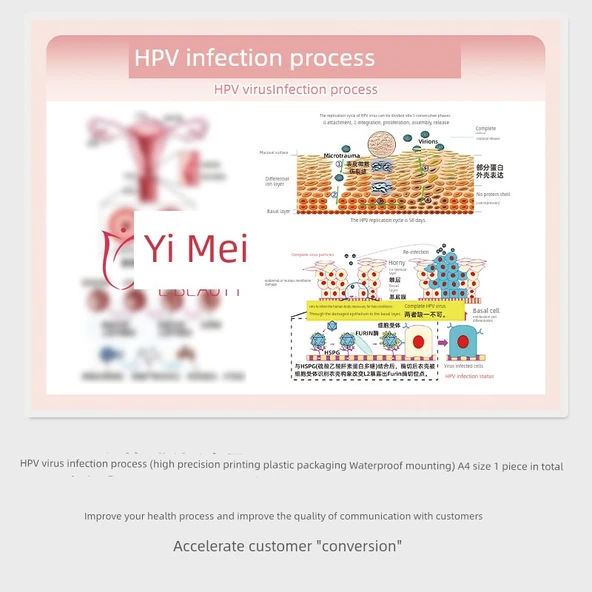 Jinekolojik Anatomi Atlası Poster - HPV Enfeksiyon Süreci - A4