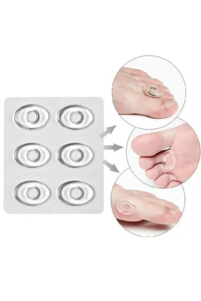 MEDLİGHT Nasır Bandı - Delikli Silikon Ped - Delikli Silikon Ped - 6 Adet - 2