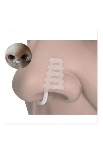 MİNİON Horlama Önleyici Rahat Nefes Alma Burun Açıcı Uyku Aparatı 10 Paket Oksimax ürün görseli