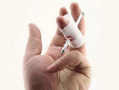 Çivili Parmak - Resim 3