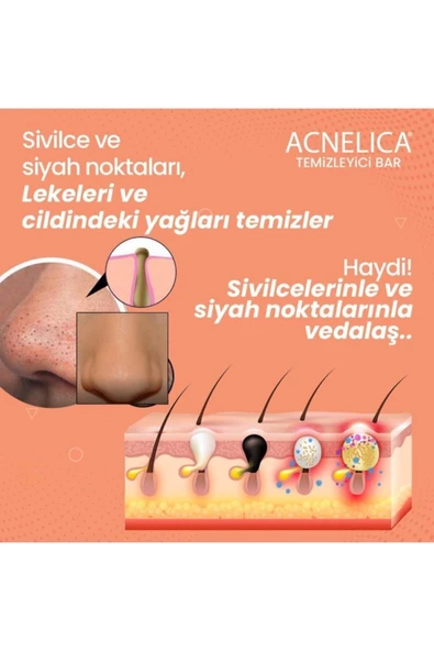 Acnelica Temizleyici Bar %2 Siyah Nokta Ve Sivilce Sabunu - 3
