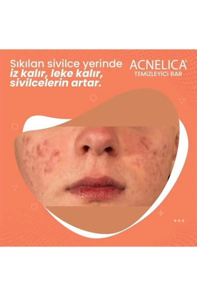 Acnelica Temizleyici Bar %2 Siyah Nokta Ve Sivilce Sabunu - 4