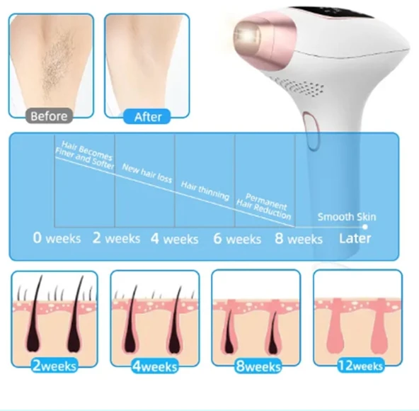 nwn3 Acısız IPL Buz Lazer Epilasyon Cihazı 999.999 Flaş Atım Tüm Vücut - Yüz - 3