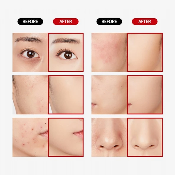 Merythod Dual Concealer 01 Pure Ivory - Çift Uçlu Kapatıcı (Stick ve Likit) - 10
