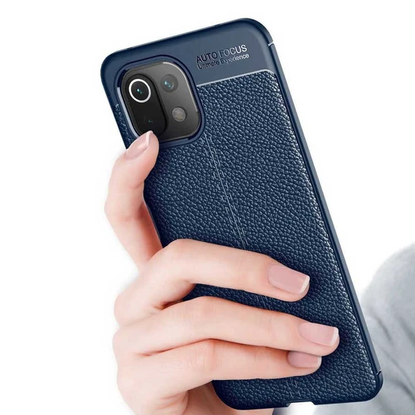 Xiaomi Mi 11 Deri Görünümlü Firo Silikon Kılıf - Resim 4