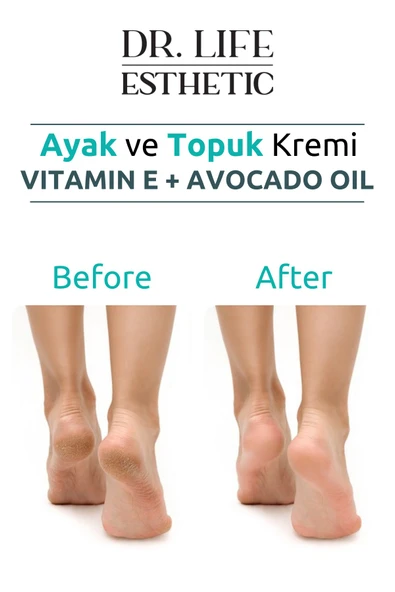 DR. LİFE ESTHETİC AYAK VE TOPUK BAKIM KREMİ 100 ML - 4