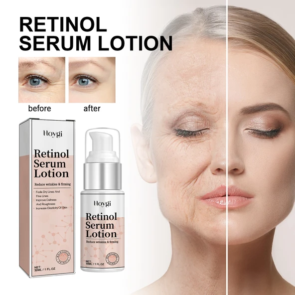 Retinol Serum Losyon - İnce Çizgi ve Kırışıklık Karşıtı - Nemlendirici - 30ml