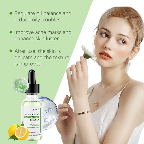 Azelaik Asit Akne Tedavi Serumu - 30ml - Gözenek Sıkılaştırıcı ve Nemlendirici