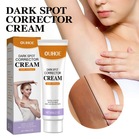 Krem - Koyu Leke Giderici, Nemlendirici ve Aydınlatıcı Vücut Losyonu - 60ml