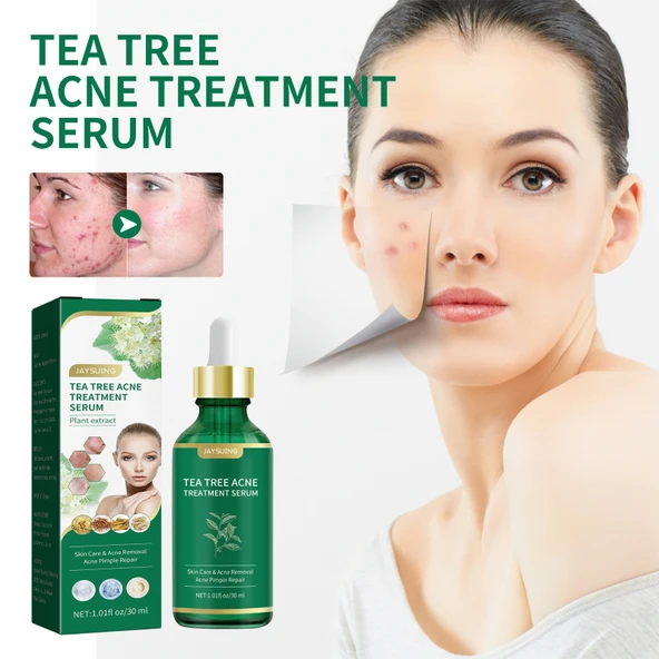 Çay Ağacı Yağı Akne Serumu - 30ml