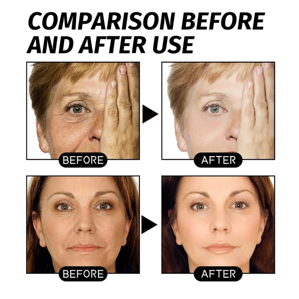 Retinol Altın Yüz Maskesi - Gözenek Temizleme, İnce Çizgi Azaltma, Cilt Sıkılaştırma, Nemlendirici - 100g - 4