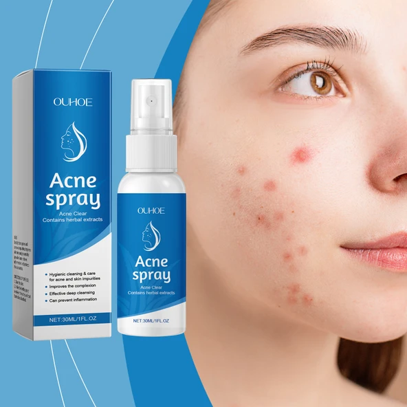 Yüz Rahatlatıcı Bitkisel Sprey - 30ml