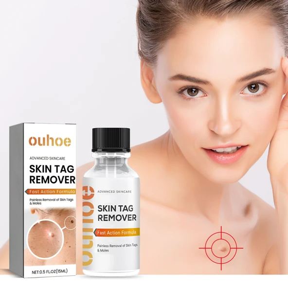 Cilt Leke Giderici Serum - Siğil, Ben ve Nasır Tedavisi - 15ml