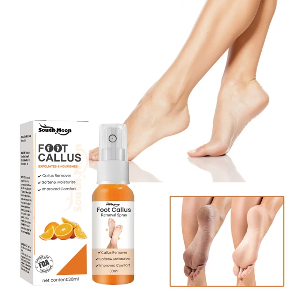 Ayak Nasır Sökücü Sprey - 30ml - Ölü Deri Temizleyici