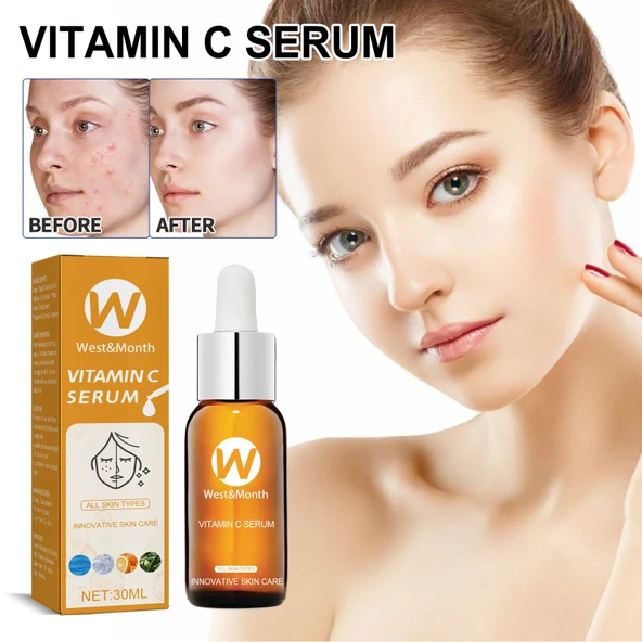 Yüz Bakım Esansı - 30ml - Akne Kontrolü ve Cilt Sıkılaştırma
