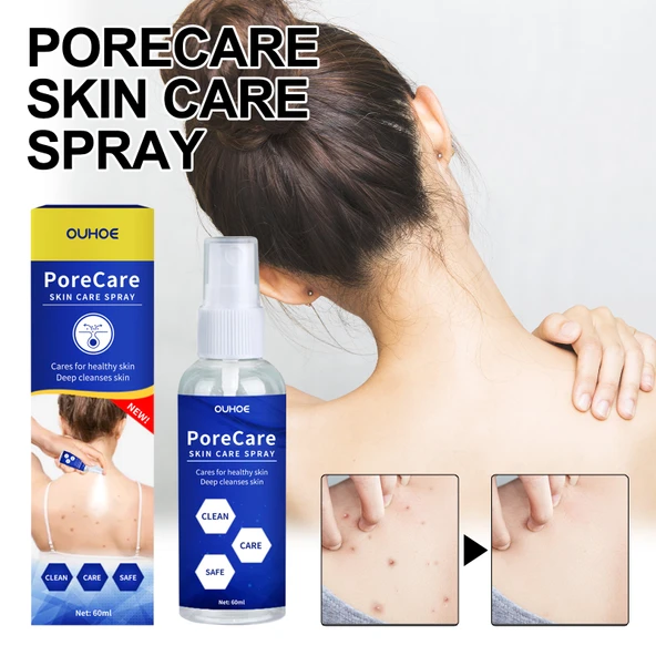 Porecare Cilt Bakım Spreyi - Siğil, Ben ve Nasır Giderici - 60ml - 2