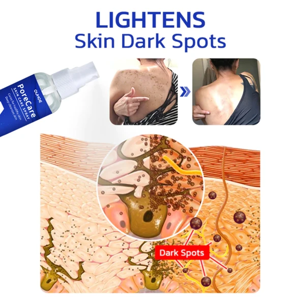 Porecare Cilt Bakım Spreyi - Siğil, Ben ve Nasır Giderici - 60ml - 3