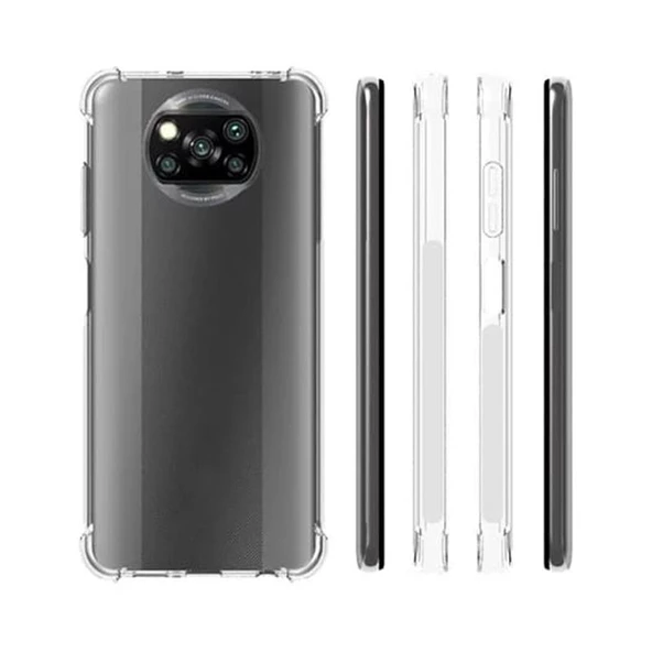 Gpack Xiaomi Poco X3 NFC Kılıf AntiShock Koruma Sert Silikon Full Nano Ekran - 3