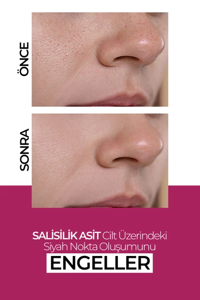 NEW WELL Nemlendirici Cilt Yenileyici Leke Karşıtı Krem 50ML - 3